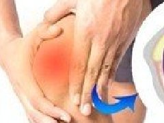 不同类型的关节炎有什么症状？