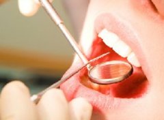 引发口腔癌的因素有哪些？