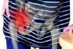 股骨头坏死有哪些临床表现？