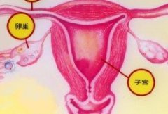 卵巢癌的并发症有哪些？