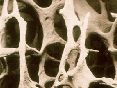 骨质疏松会有哪些危害？