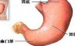 哪些是年轻人患胃肿瘤的诱因？