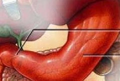 胃癌会有哪些症状？