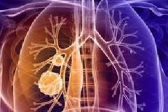 肺癌患者可做哪些检查？