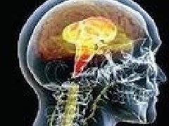 脑癌的诊断方法有哪些？