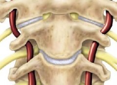骨癌的早期信号有哪些？