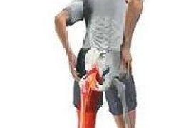 坐骨神经痛有哪些症状特点？