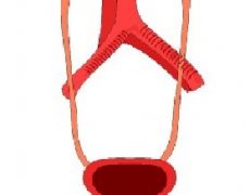 膀胱癌的病因有哪些？