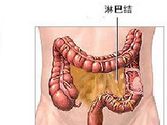 结肠癌的早期症状有哪些？