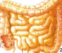结肠癌的病因有哪些？