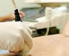 关于腹部超声检查介绍