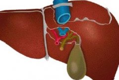 肝癌的并发症有哪些？