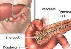 胰腺癌的晚期有哪些症状？