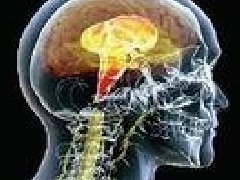 哪些是脑癌的诊断方法？