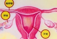 卵巢癌有哪些并发症？