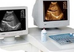 前列腺癌有哪些检查方法？