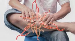 【健康】抽筋只是因为缺钙？3分钟读懂抽筋8大原因