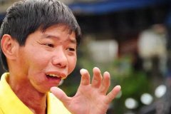 割掉舌头，切去牙床，这群“割脸人”用生命告诉我们远离槟榔