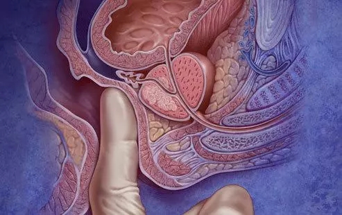 【预约】陪你走在健康“前列”，免费领取前列腺癌筛查名额！