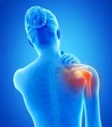 夏季是肩周炎的高发期！空调可以开，“康复操”不能不做！