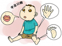 手足口病又开始磨刀霍霍，家长如何从容应对？