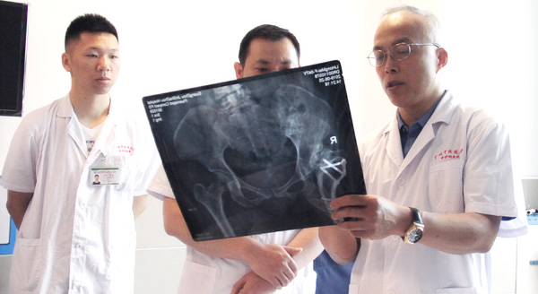 为什么有的人年纪轻轻，却患上股骨头坏死？