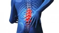 腰椎间盘突出需重视，找专业医生对症治疗很重要！