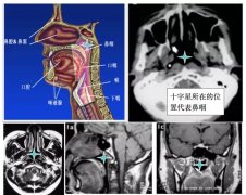 这几个症状频繁出现，小心鼻咽癌“找上门”！