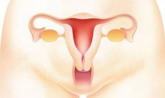 宫颈糜烂真不是病，还有多少女人不知道这个事实？